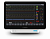 Монитор пациента K18 Pro Comen